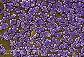 Staph Found In Locker Room, No Soap In Bathroom